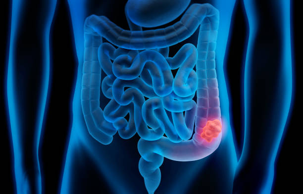 overview Battling Stomach Cancer At 30